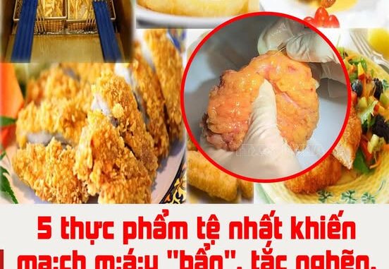 5 thực phẩm tệ nhất khiến ᴍᴀ̣ᴄʜ ᴍᴀ́ᴜ “bẩn”, tắc nghẽn, dễ bị độт qυу̣: Số 4 là món khoái khẩu của nhiều người