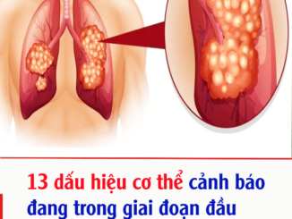 13 dấu hiệu cơ thể cảnh báo đang trong giai đoạn đầu của ung thư trước 2-5 năm