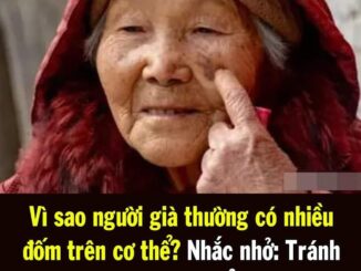 Vì sao người già thường có nhiều đốm trên cơ thể? Nhắc nhở: Tránh xa 3 thói quen sau tuổi 50 có thể làm giảm đồi mồi