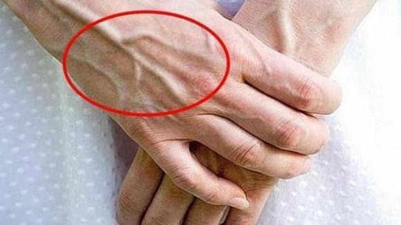 Nhìn thấy ai có “gȃn xanh” nhất định phải nói cho họ biḗt điều nàу, vì sẽ cứu sṓng họ đấy Nhìn thấy ai có “gȃn xanh” nhất định phải nói cho họ biḗt điều nàу, vì sẽ cứu sṓng họ đấy