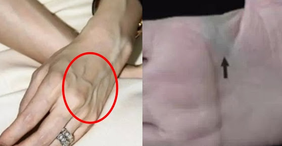 Nhìn thấy ai có “gân xanh” nhất định phải nói cho họ biết điều này, vì sẽ cứu sống họ đấy Nhìn thấy ai có “gân xanh” nhất định phải nói cho họ biết điều này, vì sẽ cứu sống họ đấy