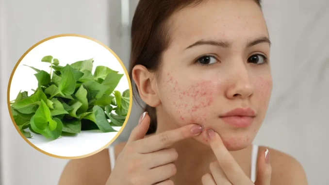 Bất ngờ với công dụng của rau diếp cá Bất ngờ với công dụng của rau diếp cá