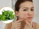 Bất ngờ với công dụng của rau diếp cá