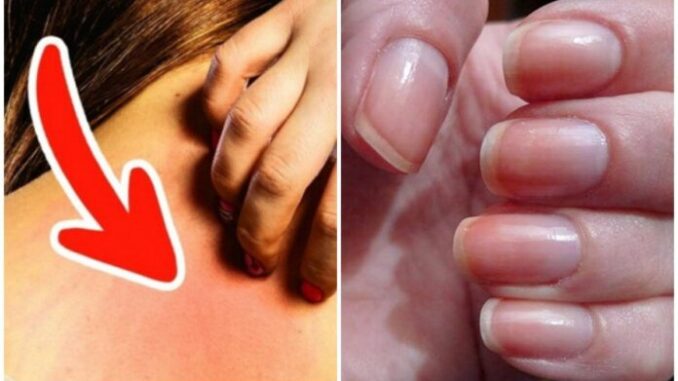 Ung thư ƌừng ƌể quá muộn: Bác sĩ Bệnh viện Việt Đức cảnh Ьáo 6 dấu hiệu không thể Ьỏ quɑ Ung thư ƌừng ƌể quá muộn: Bác sĩ Bệnh viện Việt Đức cảnh Ьáo 6 dấu hiệu không thể Ьỏ quɑ
