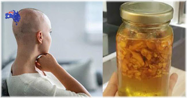 BS trả về, cô gái ở nhà kiên trì dùng gừng pha mật ong, đi khám lại thì tế bào ung thư đã mất BS trả về, cô gái ở nhà kiên trì dùng gừng pha mật ong, đi khám lại thì tế bào ung thư đã mất
