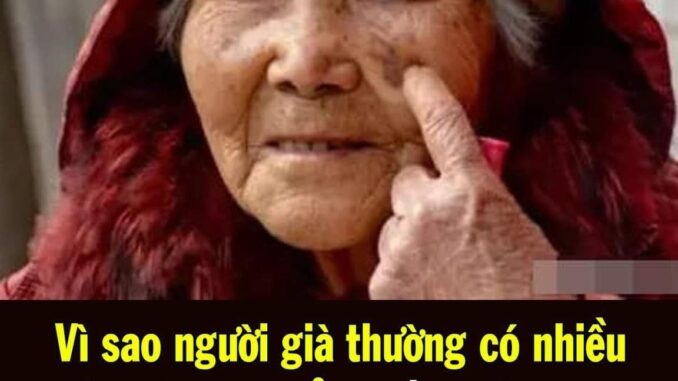 Vì sao người già thường có nhiều đốm trên cơ thể? Nhắc nhở: Tránh xa 3 thói quen sau tuổi 50 có thể làm giảm đồi mồi Vì sao người già thường có nhiều đốm trên cơ thể? Nhắc nhở: Tránh xa 3 thói quen sau tuổi 50 có thể làm giảm đồi mồi