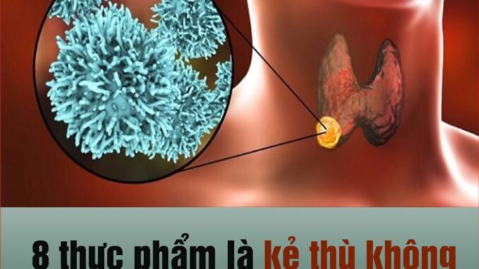 8 thực phẩm không đội trời chung với các khối u, nhắc nhau nhớ ăn thường xuyên 8 thực phẩm không đội trời chung với các khối u, nhắc nhau nhớ ăn thường xuyên