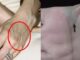 Nhìn thấy ai có “gân xanh” nhất định phải nói cho họ biết điều này, vì sẽ cứu sống họ đấy