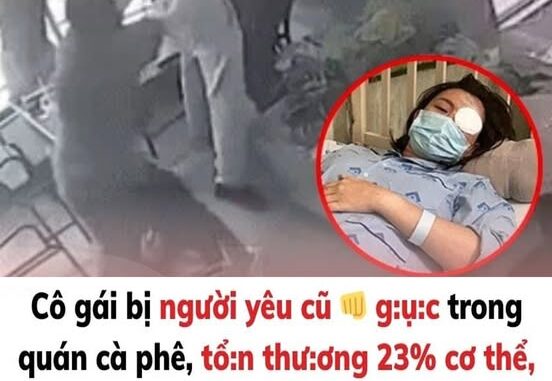 Cô gái bị người yêu cũ tác động vật lý trong quán cà phê, tổn thương 23% cơ thể: Yêu cầu bồi thường 900 triệu đồng Cô gái bị người yêu cũ tác động vật lý trong quán cà phê, tổn thương 23% cơ thể: Yêu cầu bồi thường 900 triệu đồng
