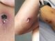 Cảnh báo căn bệnh hiếm gặp xuất hiện ở Việt Nam