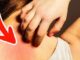 Ung thư ƌừng ƌể quá muộn: Bác sĩ Bệnh viện Việt Đức cảnh Ьáo 6 dấu hiệu không thể Ьỏ quɑ