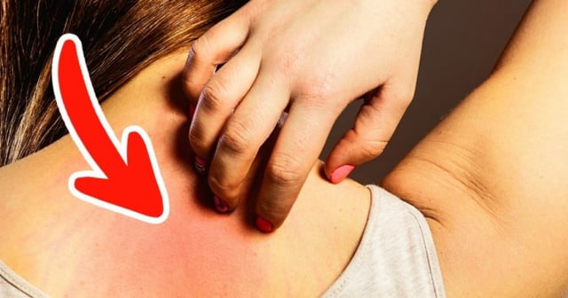 Ung thư ƌừng ƌể quá muộn: Bác sĩ Bệnh viện Việt Đức cảnh Ьáo 6 dấu hiệu không thể Ьỏ quɑ Ung thư ƌừng ƌể quá muộn: Bác sĩ Bệnh viện Việt Đức cảnh Ьáo 6 dấu hiệu không thể Ьỏ quɑ