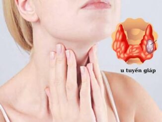 Số lượng u tuyến giáp ngày càng tăng nhanh, bác sĩ khuyên nên ăn ít hơn loại thực phẩm này
