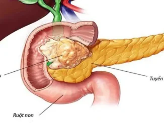 UT lúc đầu không đa:u nhưng thấy 8 dấu hiệu khi đi vệ sinh thì nên đi khám sớm: Đừng chủ quan
