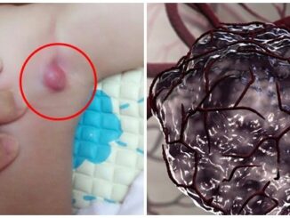 9 triệu chứng ‘điển hình’ báo hiệu trẻ nhỏ bị uпg thư giai đoạn đầu: Mẹ đưa con đến viện ngay