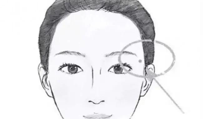 Điểm Mặt 5 Nốt Ruồi "Đế Vương" Càng Già Càng Giàu: Ai Có 1 Trong 5 Cũng Viên Mãn Cả Đời Điểm Mặt 5 Nốt Ruồi "Đế Vương" Càng Già Càng Giàu: Ai Có 1 Trong 5 Cũng Viên Mãn Cả Đời