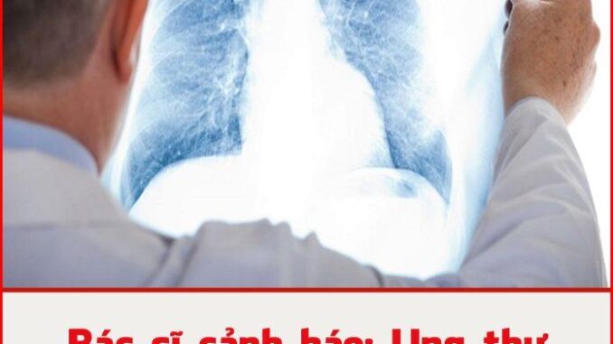 Bác sĩ cảnh báo: Ung thư phổi giai đoạn đầu không phải lúc nào cũng có ho, chú ý 4 bất thường này Bác sĩ cảnh báo: Ung thư phổi giai đoạn đầu không phải lúc nào cũng có ho, chú ý 4 bất thường này