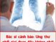 Bác sĩ cảnh báo: Ung thư phổi giai đoạn đầu không phải lúc nào cũng có ho, chú ý 4 bất thường này